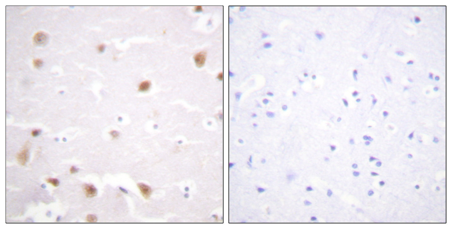 Casein Kinase IIβ Rabbit Polyclonal Antibody