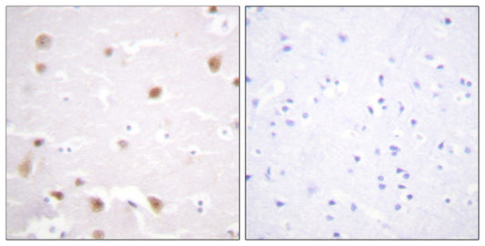 Casein Kinase IIβ Rabbit Polyclonal Antibody