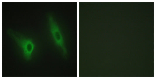 Casein Kinase Iε Rabbit Polyclonal Antibody