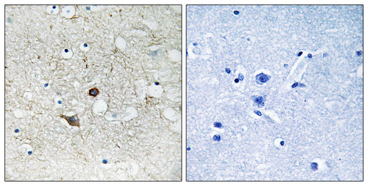Caspase-2 Rabbit Polyclonal Antibody