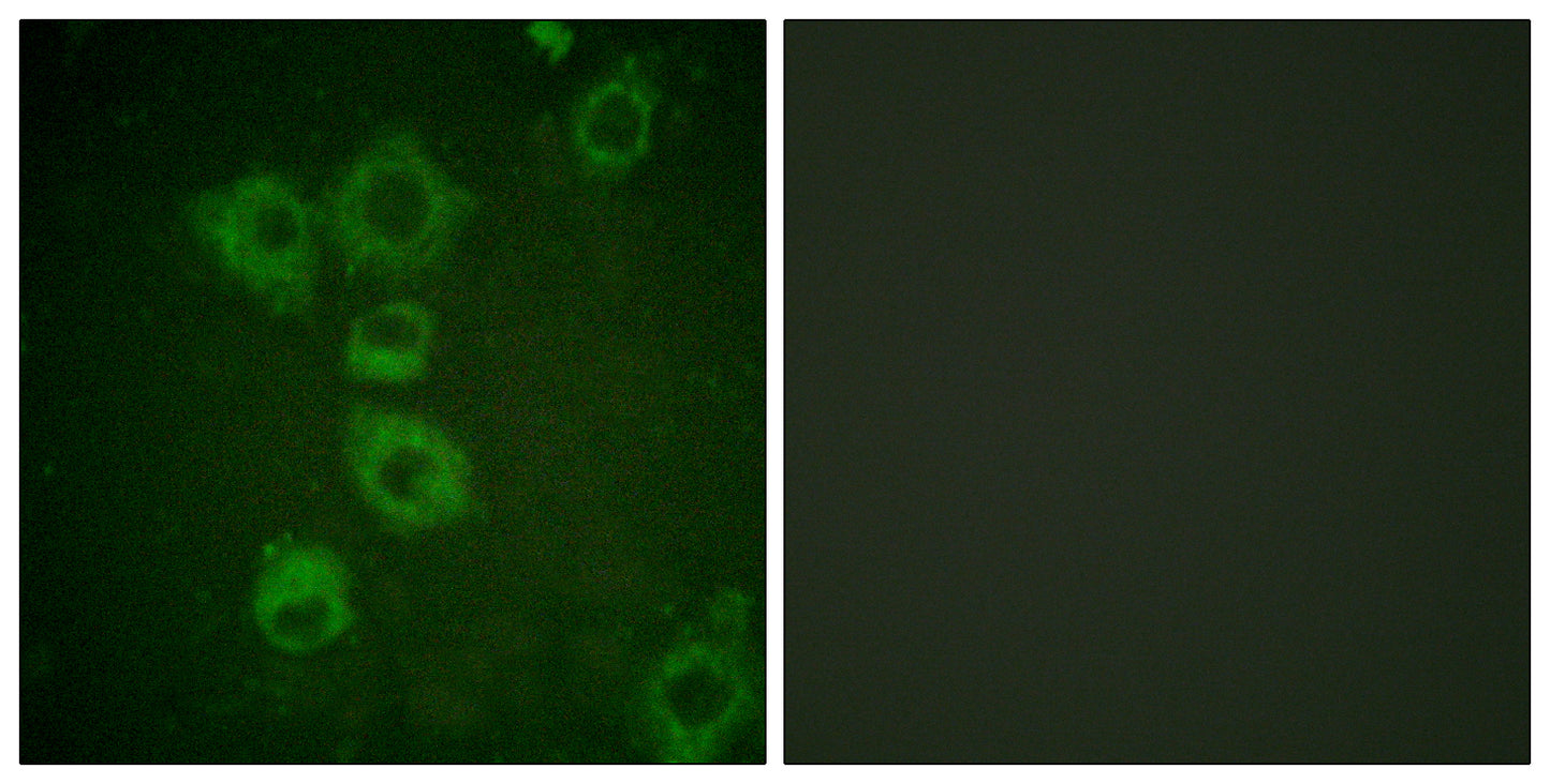 Caspase-6 Rabbit Polyclonal Antibody