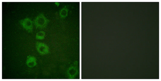 Caspase-6 Rabbit Polyclonal Antibody