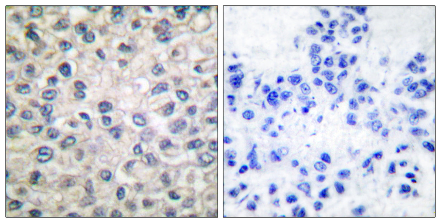 Catenin-α E/N Rabbit Polyclonal Antibody