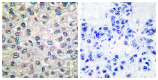 Catenin-α E/N Rabbit Polyclonal Antibody
