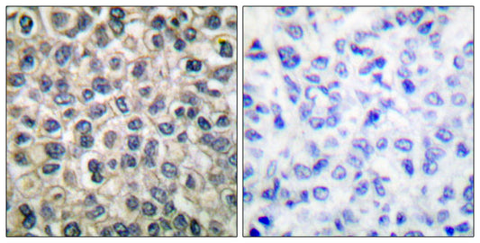 Catenin-γ Rabbit Polyclonal Antibody