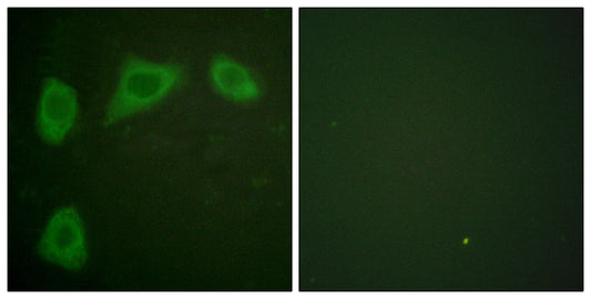 Caveolin-1 Rabbit Polyclonal Antibody