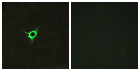CB1 Rabbit Polyclonal Antibody