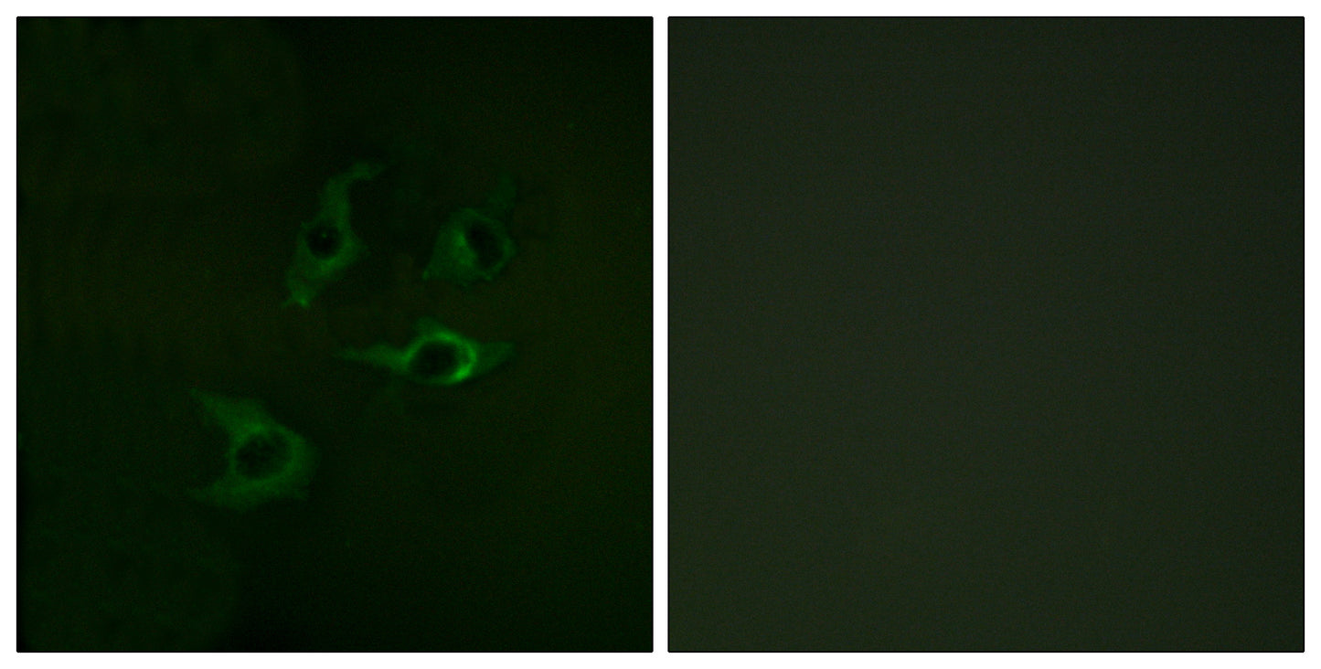 Cbl Rabbit Polyclonal Antibody