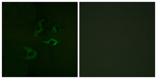 Cbl Rabbit Polyclonal Antibody