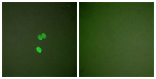 CBP 35 Rabbit Polyclonal Antibody