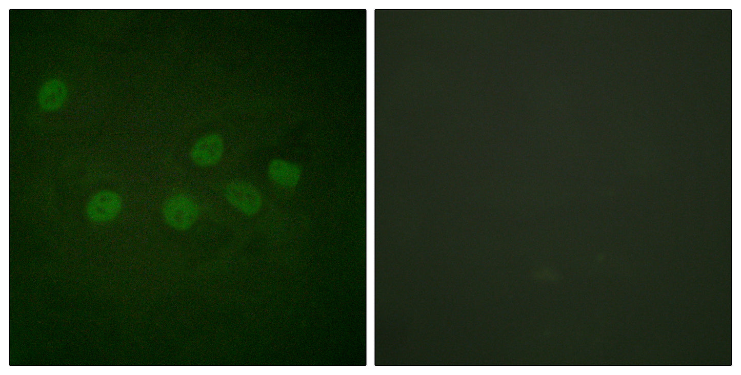 CBP Rabbit Polyclonal Antibody