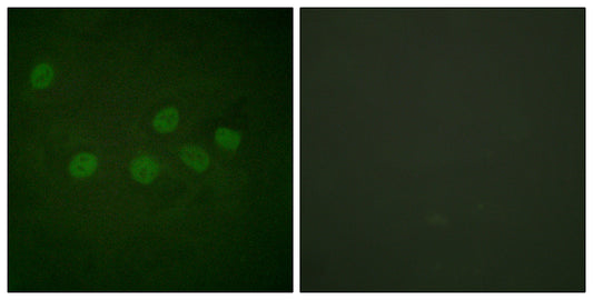 CBP Rabbit Polyclonal Antibody