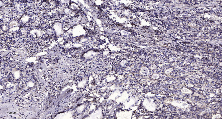 CCD19 Rabbit Polyclonal Antibody