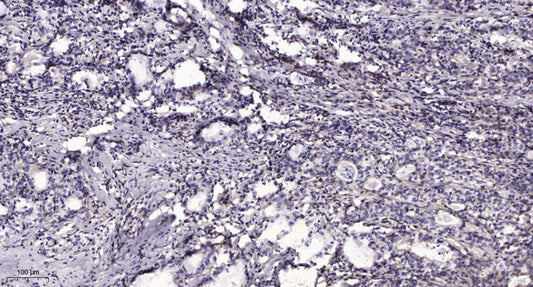 CCD19 Rabbit Polyclonal Antibody