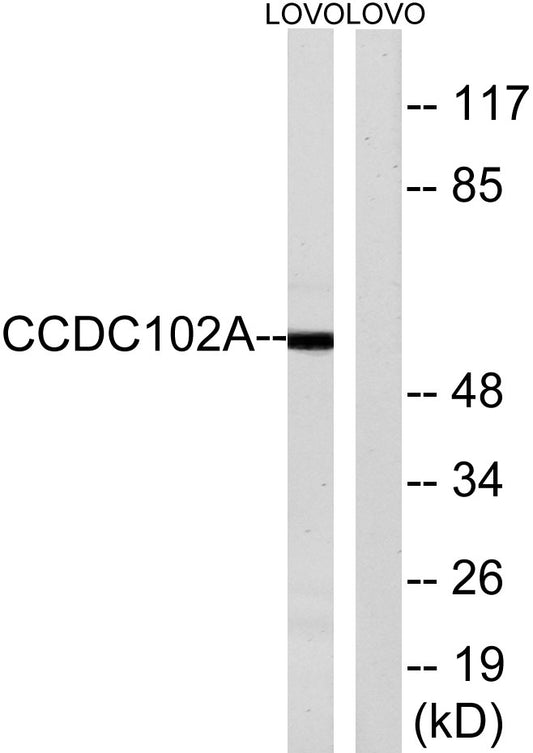 CCDC102A Rabbit Polyclonal Antibody