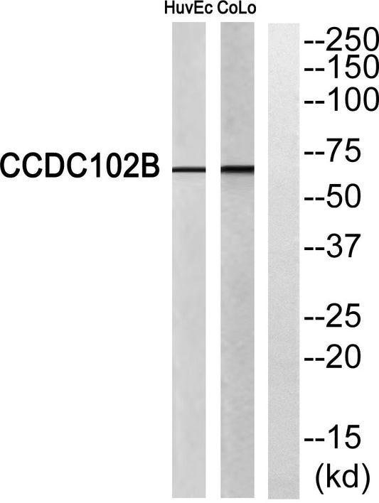 CCDC102B Rabbit Polyclonal Antibody