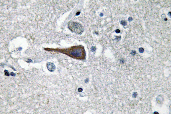 CCK Rabbit Polyclonal Antibody