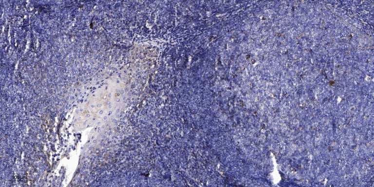 CCL18 Rabbit Polyclonal Antibody