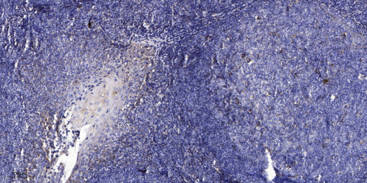 CCL18 Rabbit Polyclonal Antibody
