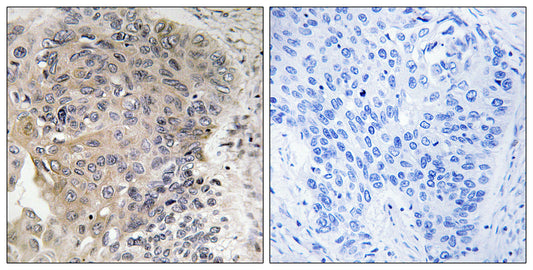 CCP3 Rabbit Polyclonal Antibody