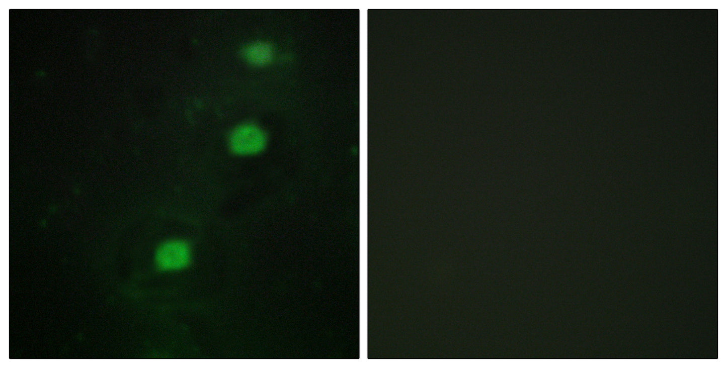 CCRK Rabbit Polyclonal Antibody