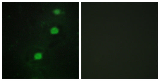 CCRK Rabbit Polyclonal Antibody