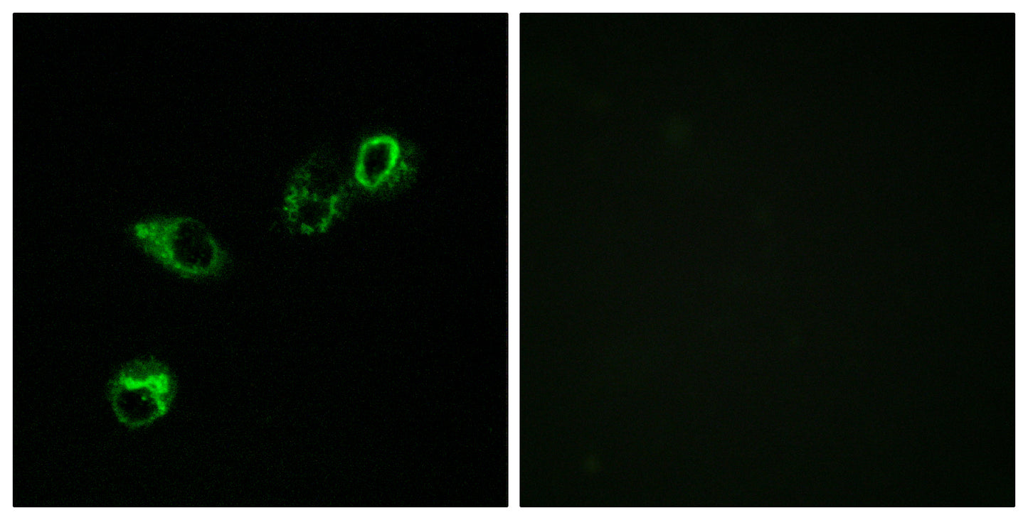 CCRL1 Rabbit Polyclonal Antibody