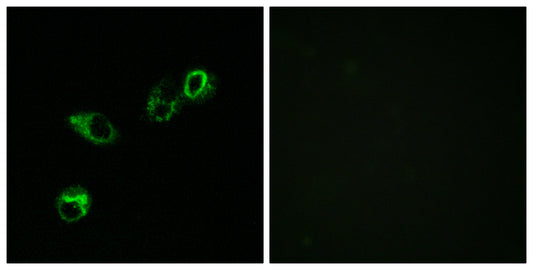 CCRL1 Rabbit Polyclonal Antibody
