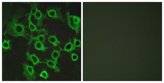 CCRL2 Rabbit Polyclonal Antibody
