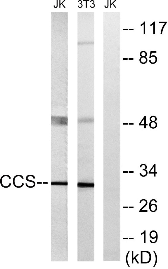 CCS Rabbit Polyclonal Antibody