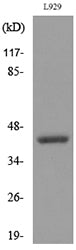 CD116 Rabbit Polyclonal Antibody