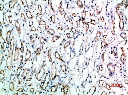 CD151 Rabbit Polyclonal Antibody