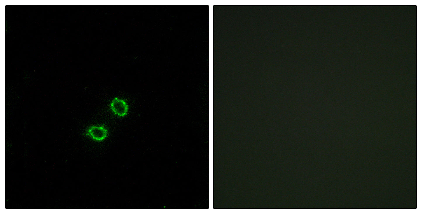 CD158f2 Rabbit Polyclonal Antibody