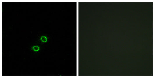 CD158f2 Rabbit Polyclonal Antibody