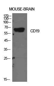 CD19 Rabbit Polyclonal Antibody