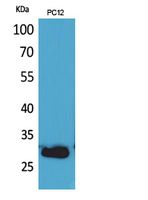 CD200 Rabbit Polyclonal Antibody