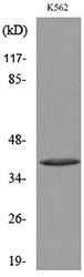 CD207 Rabbit Polyclonal Antibody