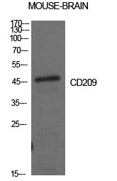 CD209 Rabbit Polyclonal Antibody