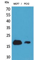 CD225 Rabbit Polyclonal Antibody