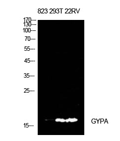 CD235a Rabbit Polyclonal Antibody