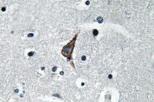CD284 Rabbit Polyclonal Antibody