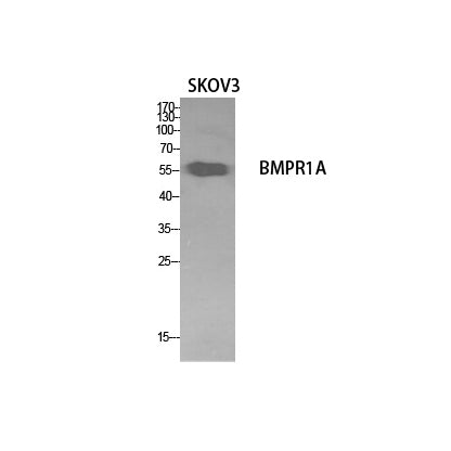 CD292 Rabbit Polyclonal Antibody