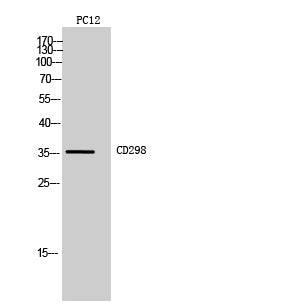 CD298 Rabbit Polyclonal Antibody