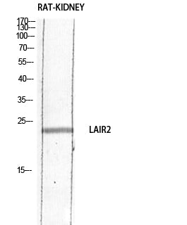 CD306 Rabbit Polyclonal Antibody