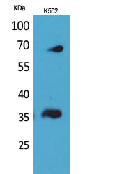 CD32-B/C Rabbit Polyclonal Antibody