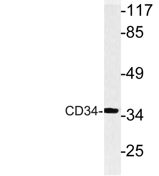 CD34 Rabbit Polyclonal Antibody