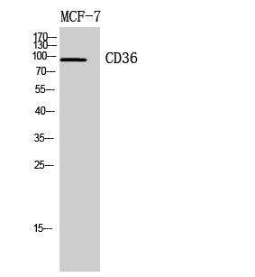 CD36 Rabbit Polyclonal Antibody