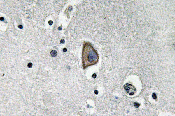 CD3-ε Rabbit Polyclonal Antibody