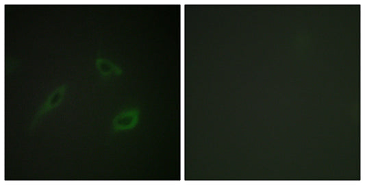 CD4 Rabbit Polyclonal Antibody