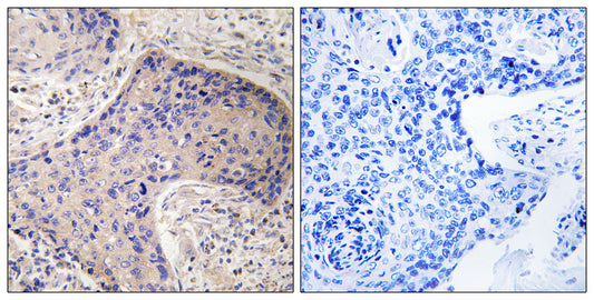 CD75 Rabbit Polyclonal Antibody